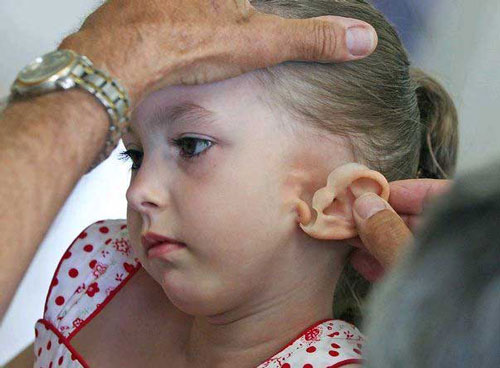 Doctor help girl get eardrum